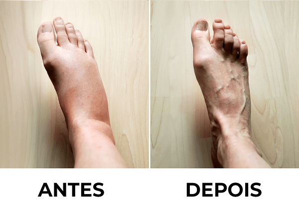 Passo 3: Descanso — Como aplicar a pomada e o spray Destravador